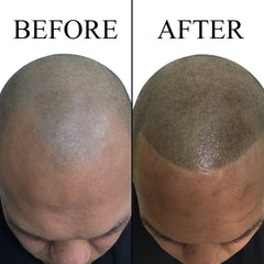 Follifill SMP Pigment Kit